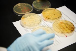 Photo of bacteria cultures